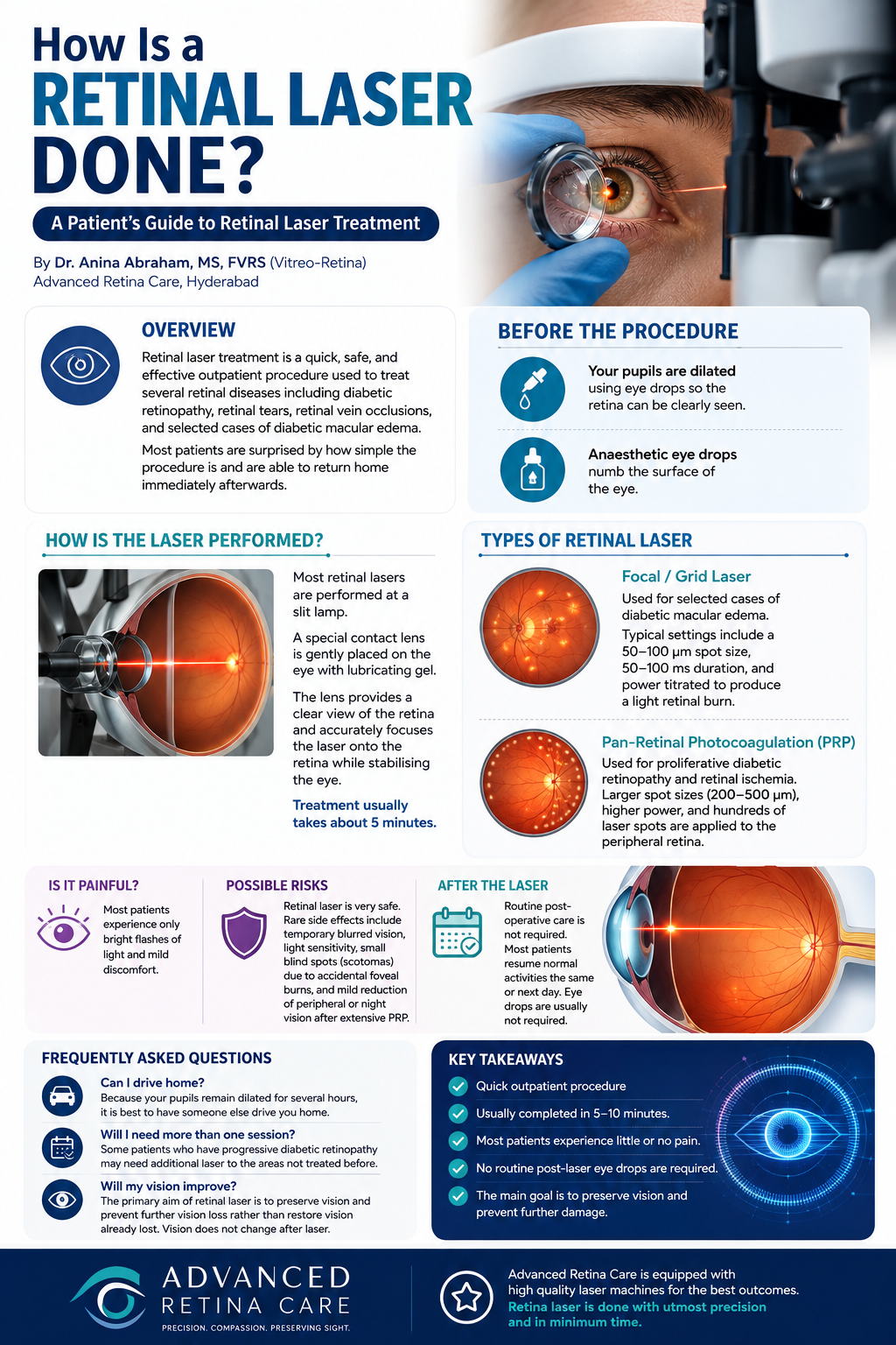 Retinal Laser Procedure